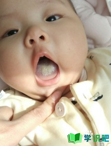 婴儿舌苔发白怎么回事？
