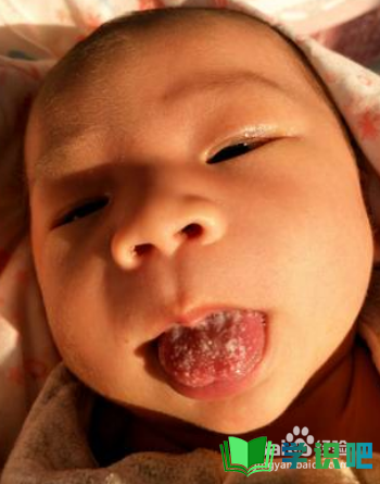 婴儿舌苔发白怎么回事？ 第5张