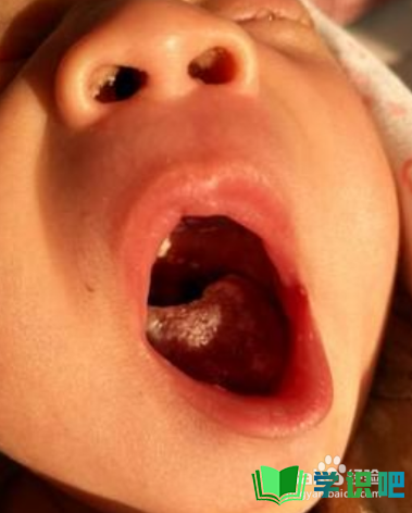 婴儿舌苔发白怎么回事？ 第7张
