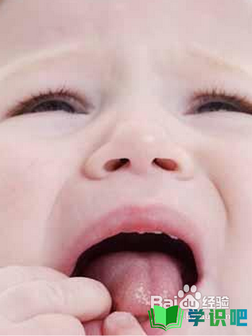 婴儿舌苔厚白怎么办？