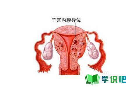 女性经期后有褐色分泌物是怎么回事？ 第2张