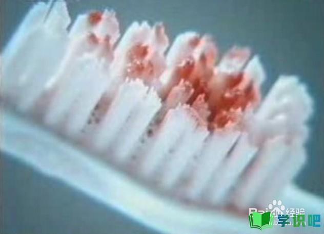 每天刷牙牙齿都会出血是怎么回事？