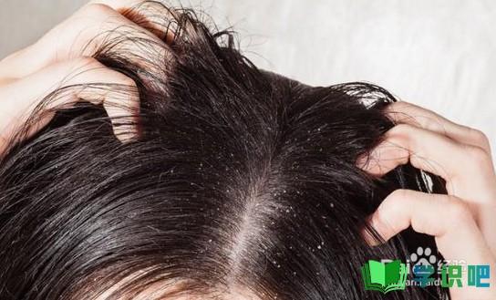 头发容易油怎么办？