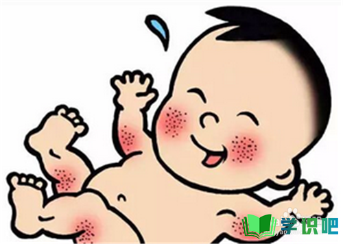 两个半月宝宝湿疹怎么办？
