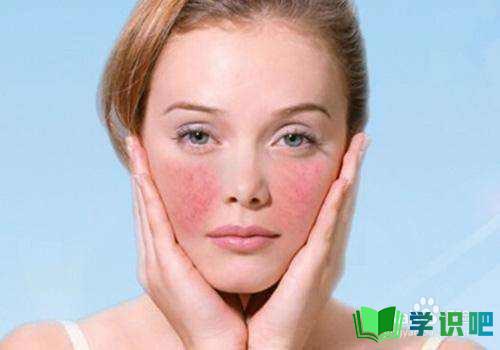 皮肤经常过敏怎么办？