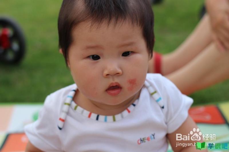 宝宝脸上起湿疹怎么办？